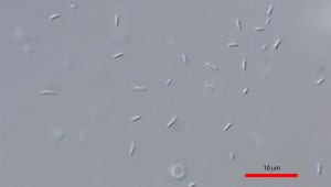 fig-2-sperm-image
